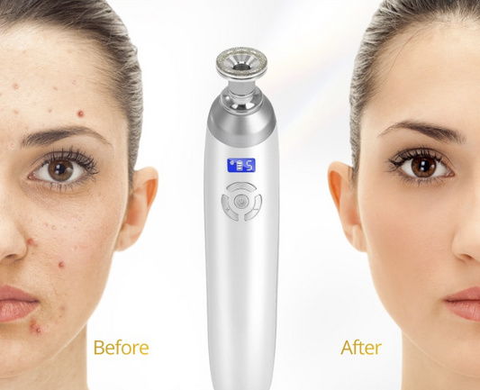Cordless Diamond Microdermabrasion Machine with 9 Diamond Tips For Home Use